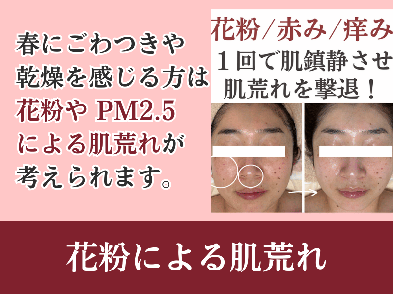 花粉による肌荒れ