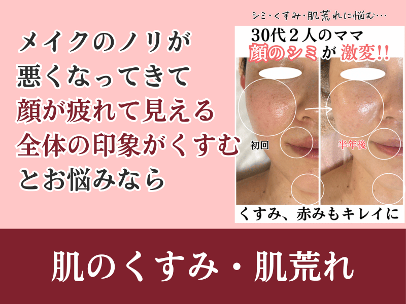 肌のくすみ・肌荒れ